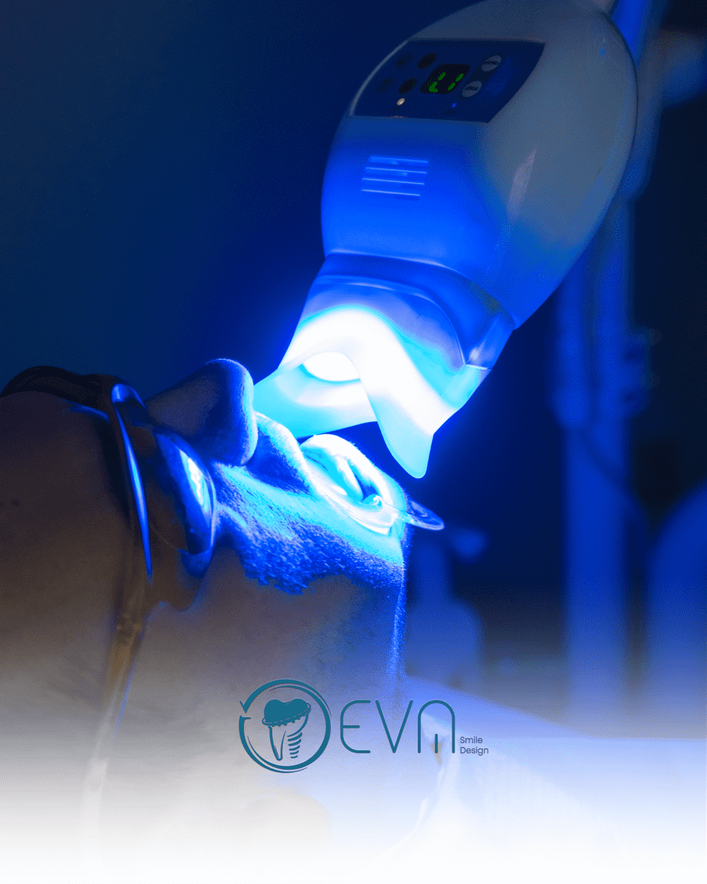 dental treatment